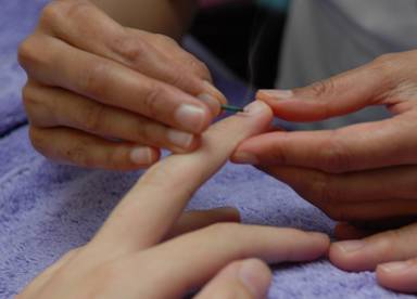 acupunture meridian points