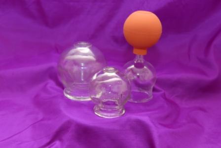 Cupping tools - Cupping Therapy - &copy; Copyright Holistic Tranquillity Coventry