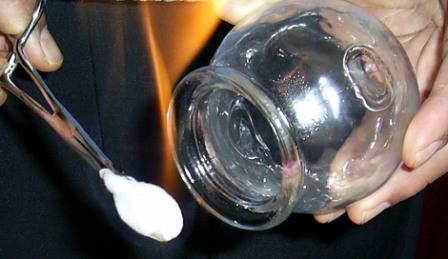 Frozen Shoulder Cupping Therapy - &copy; Copyright Holistic Tranquillity Coventry
