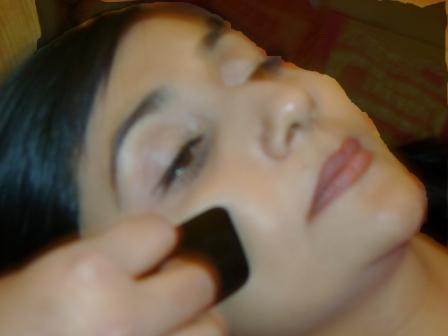 facial revitalisation Acupuncture -guasha