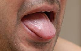 Tongue diagnosis © Copyright Holistic Tranquillity Coventry